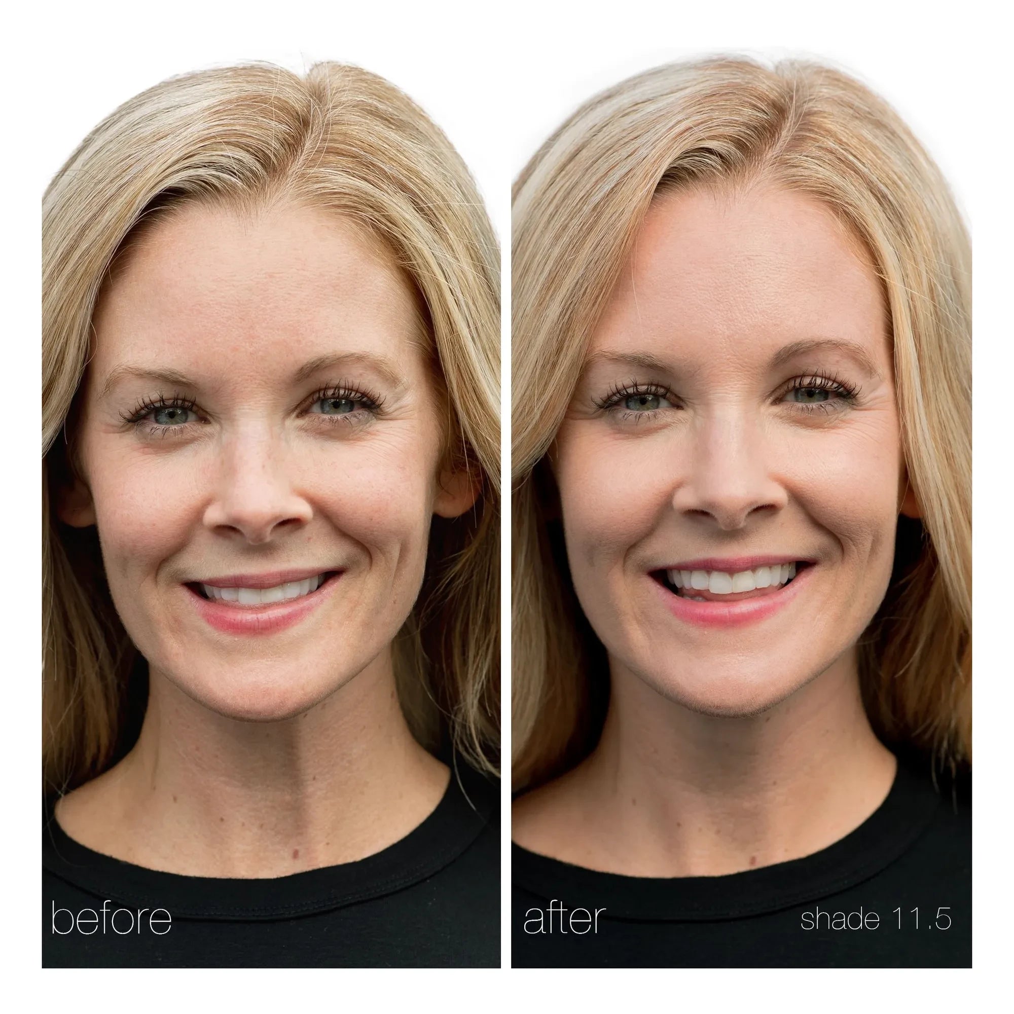 RMS Beauty - UnCoverup Concealer - 5.67 g | 11.5